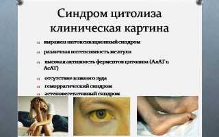 Синдром цитолиза при заболеваниях печени