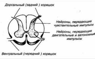 Остеохондроз корешковый синдром как вылечить