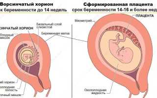 Остатки плацентарной ткани после родов код мкб