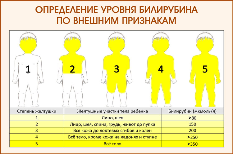 Определение уровня билирубина у новорожденных