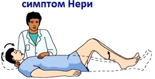 Лечение корешкового синдрома шейного отдела народными средствами