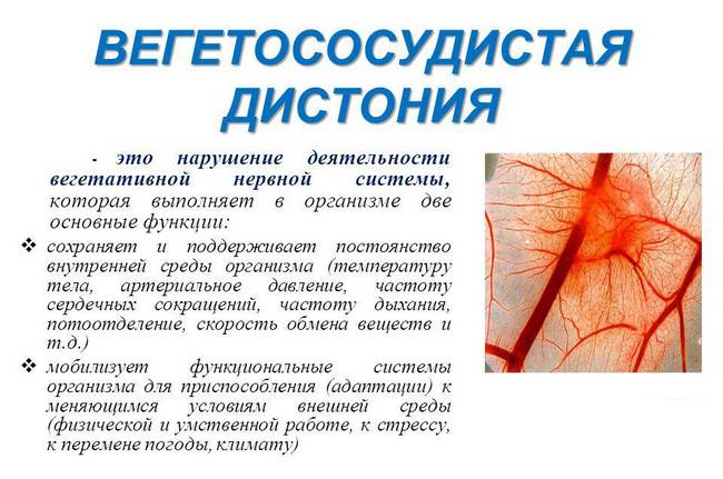 Вегетососудистая дистония (ВСД)