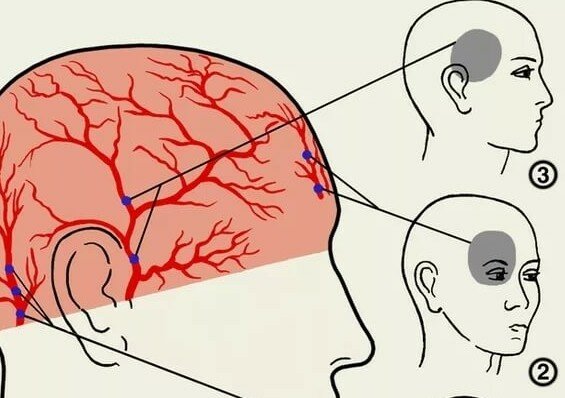 почему голова болит каждый день и глаза