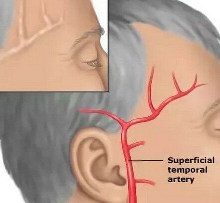 Болит голова правый затылок и правый висок
