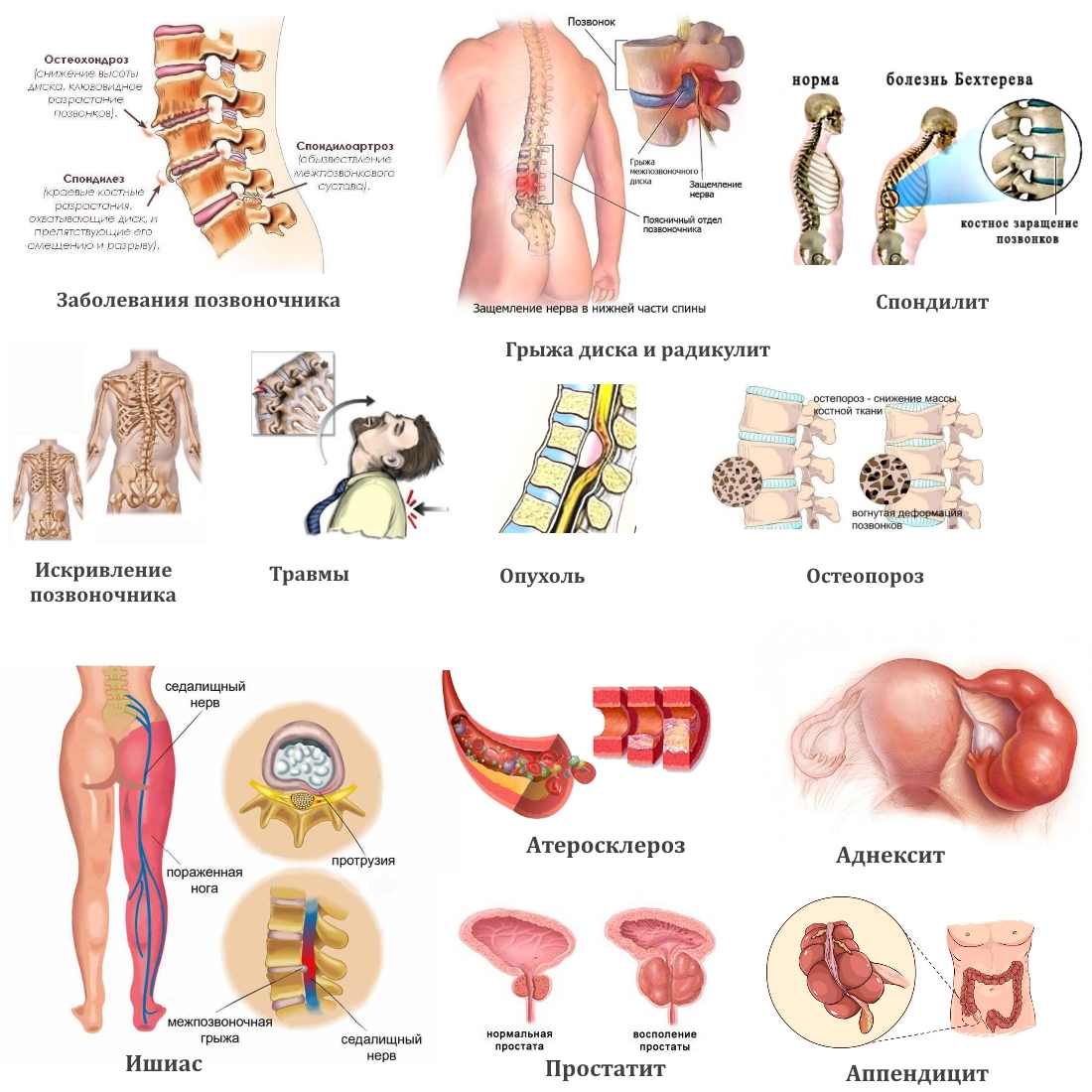Частые причины боли в спине Частые причины боли в спине