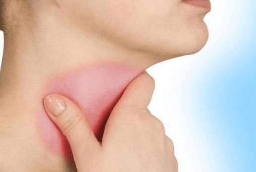 сильно болит горло и голова без температуры