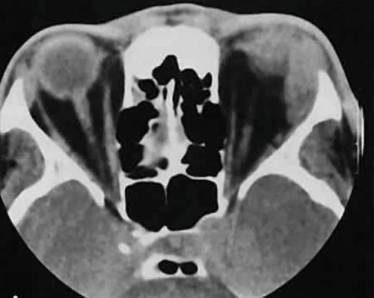 Из за чего может болеть спина и температура
