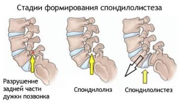 Болит спина в лежачем положении ночью