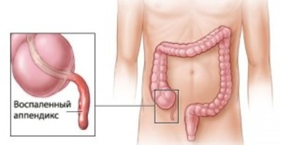 Если рвет голова болит желудок болит