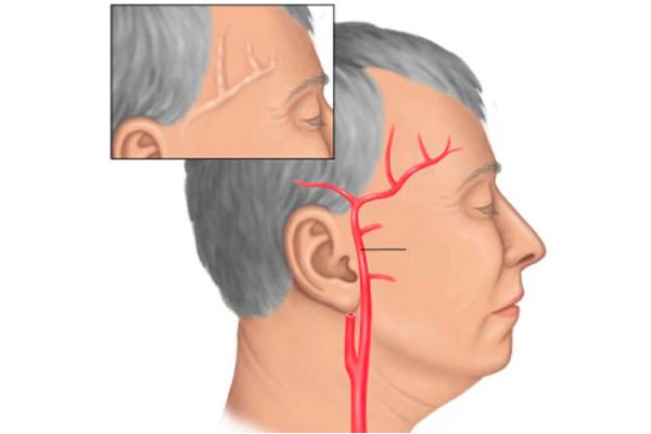 Если болит голова а обезболивающие не помогают
