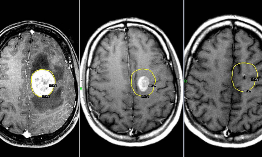 Голова болит от смартфона