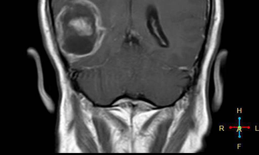 Голова болит от смартфона