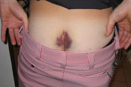 Болит спина и копчик у ребенка