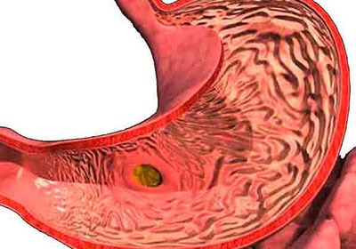 Если рвет голова болит желудок болит