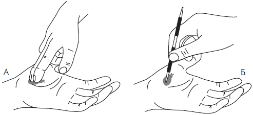 Су джок болит голова