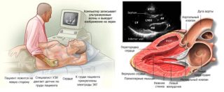 Болят мышцы спины груди
