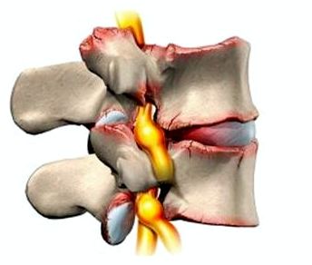 Почему не чем дышать болит за ребрами и спина
