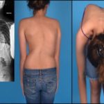 Если болит спина и отдает в грудину