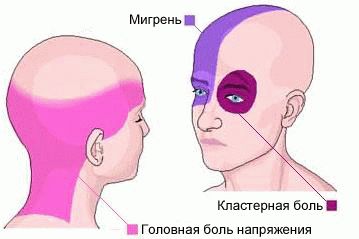 Если болит голова а обезболивающие не помогают
