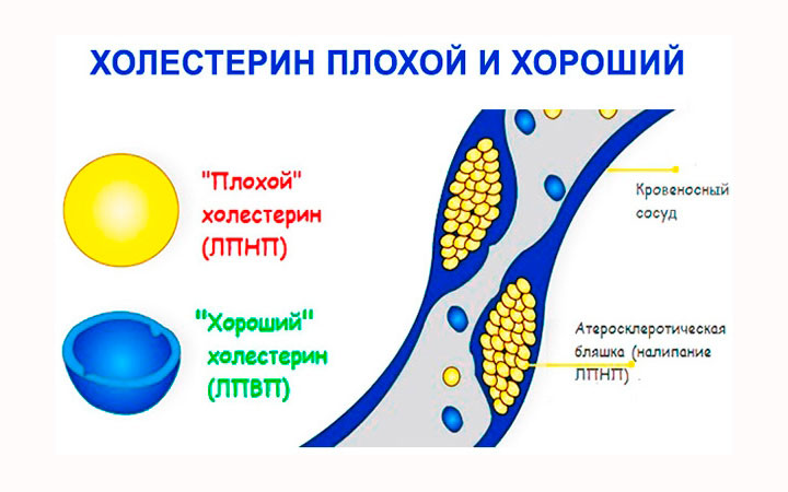 Хороший и плохой холестерин Хороший и плохой холестерин