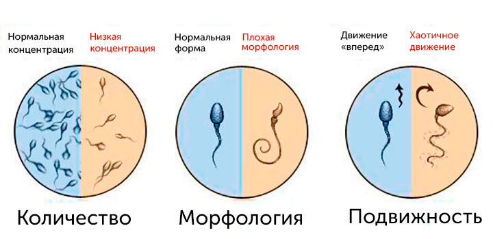 Количество, морфология и подвижность сперматозоидов Количество, морфология и подвижность сперматозоидов