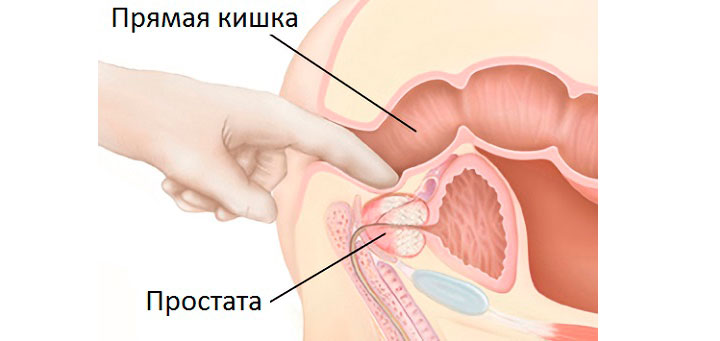 Массаж простаты Массаж простаты