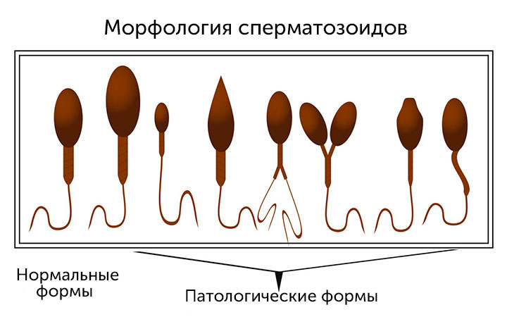 Морфология сперматозоидов Морфология сперматозоидов