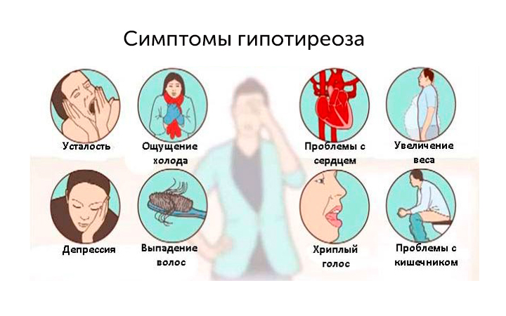 Симптомы гипотиреоза Симптомы гипотиреоза