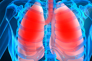 Народные рецепты от бронхита Народные средства от бронхита